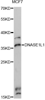 Western blot - DNASE1L1 Polyclonal Antibody 