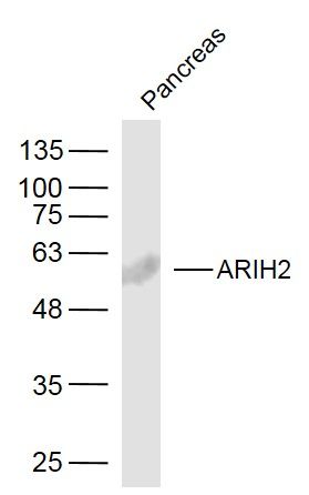 Fig1: Sample:; Pancreas (Mouse) Lysate at 40 ug; Primary: Anti-ARIH2 at 1/300 dilution; Secondary: IRDye800CW Goat Anti-Rabbit IgG at 1/20000 dilution; Predicted band size: 58 kD; Observed band size: 58 kD