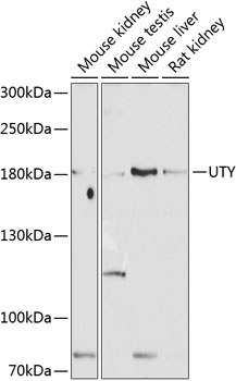 Western blot - UTY Polyclonal Antibody 