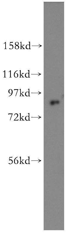 NIH/3T3 cells were subjected to SDS PAGE followed by western blot with Catalog No:109927(DHX15 antibody) at dilution of 1:300