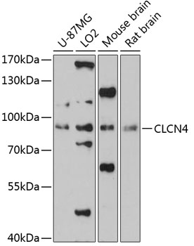 Western blot - CLCN4 Polyclonal Antibody 