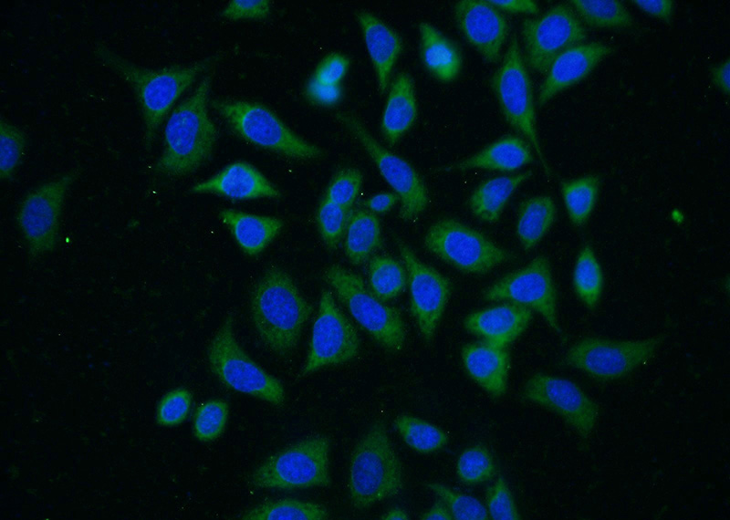 Immunofluorescent analysis of (-20oc Ethanol) fixed HeLa cells using Catalog No:113535(CDKN2B Antibody) at dilution of 1:25 and Alexa Fluor 488-congugated AffiniPure Goat Anti-Rabbit IgG(H+L)