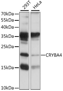 Western blot - CRYBA4 Polyclonal Antibody 