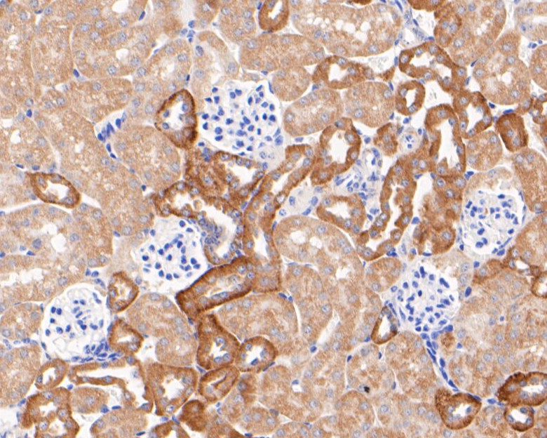 Fig3: Immunohistochemical analysis of paraffin-embedded mouse kidney tissue using anti-Kir5.1 antibody. The section was pre-treated using heat mediated antigen retrieval with Tris-EDTA buffer (pH 8.0-8.4) for 20 minutes.The tissues were blocked in 5% BSA for 30 minutes at room temperature, washed with ddH2O and PBS, and then probed with the primary antibody ( 1/50) for 30 minutes at room temperature. The detection was performed using an HRP conjugated compact polymer system. DAB was used as the chromogen. Tissues were counterstained with hematoxylin and mounted with DPX.