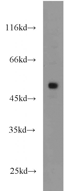 HL-60 cells were subjected to SDS PAGE followed by western blot with Catalog No:110687(FLI1 antibody) at dilution of 1:1000