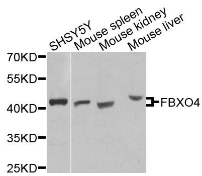 Western blot - FBXO4 Polyclonal Antibody 