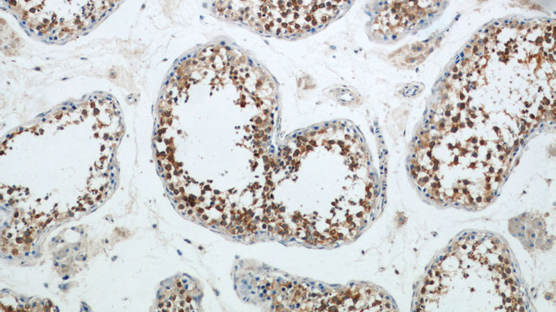 Immunohistochemical of paraffin-embedded human testis using Catalog No:109337(CLDN11 antibody) at dilution of 1:50 (under 10x lens)