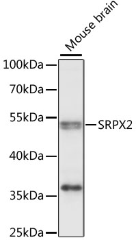 Western blot - SRPX2 Polyclonal Antibody 