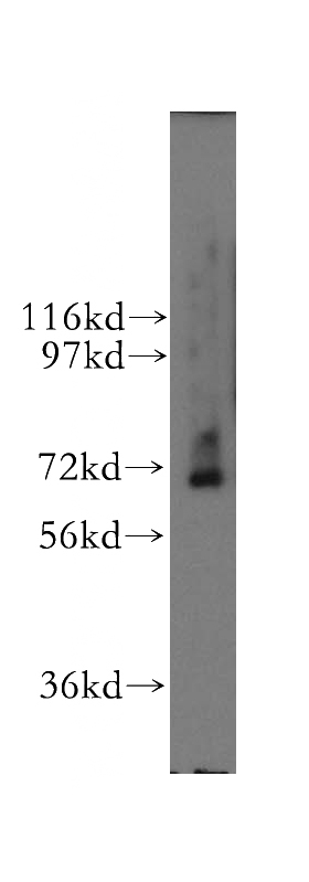 human kidney tissue were subjected to SDS PAGE followed by western blot with Catalog No:114766(RNGTT antibody) at dilution of 1:800