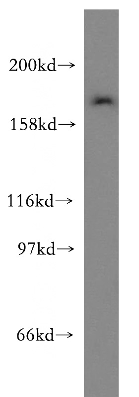 MDA-MB-453s cells were subjected to SDS PAGE followed by western blot with Catalog No:117045(ZFYVE16 antibody) at dilution of 1:400