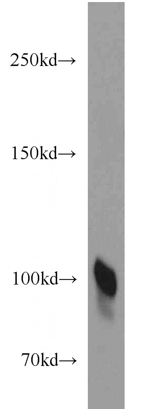human placenta tissue were subjected to SDS PAGE followed by western blot with Catalog No:113941(PLG antibody) at dilution of 1:1500