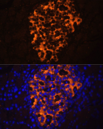 Immunofluorescence - PNLIPRP2 Polyclonal Antibody 