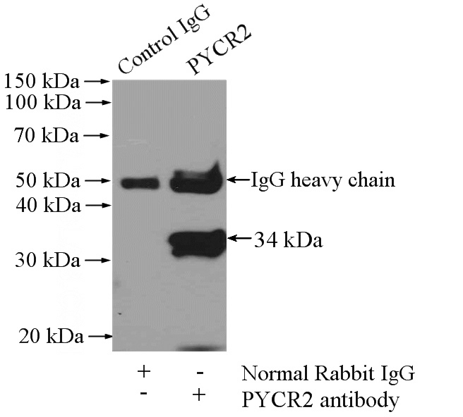 IP Result of anti-PYCR2 (IP:Catalog No:114355, 4ug; Detection:Catalog No:114355 1:500) with Jurkat cells lysate 2400ug.