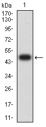 Fig1: Western blot analysis of KMT2C against human KMT2C (AA: 1-205) recombinant protein. Proteins were transferred to a PVDF membrane and blocked with 5% BSA in PBS for 1 hour at room temperature. The primary antibody ( 1/500) was used in 5% BSA at room temperature for 2 hours. Goat Anti-Mouse IgG - HRP Secondary Antibody at 1:5,000 dilution was used for 1 hour at room temperature.