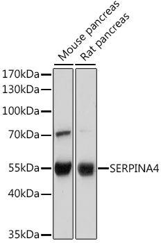 Western blot - SERPINA4 Polyclonal Antibody 