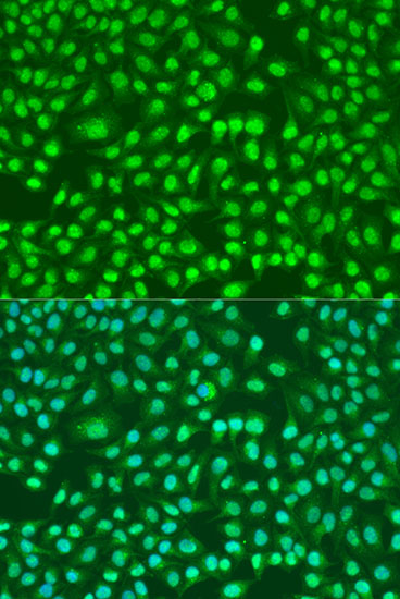 Immunofluorescence - PSEN2 Polyclonal Antibody 