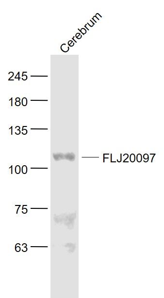 Fig1: Sample:; Cerebrum (Mouse) Lysate at 40 ug; Primary: Anti- FLJ20097 at 1/1000 dilution; Secondary: IRDye800CW Goat Anti-Rabbit IgG at 1/20000 dilution; Predicted band size: 111 kD; Observed band size: 111 kD