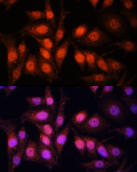 Immunofluorescence - PGC1 alpha Polyclonal Antibody 