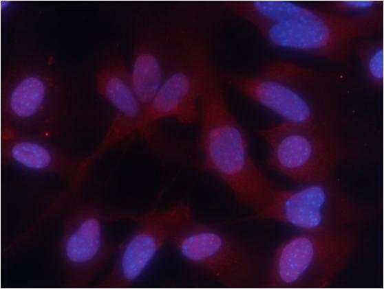 Immunofluorescence staining of methanol-fixed MEF cells using PKM2 (phospho-Ser37) Antibody .