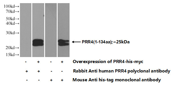 Transfected HEK-293 cells were subjected to SDS PAGE followed by western blot with Catalog No:114275(PRR4 Antibody) at dilution of 1:700