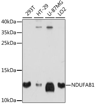 Western blot - NDUFAB1 Polyclonal Antibody 