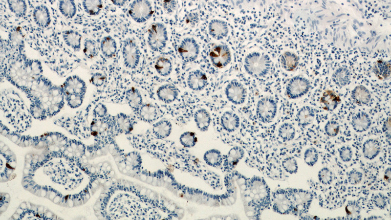 Immunohistochemical of paraffin-embedded human small intestine using Catalog No:109288(CHGA antibody) at dilution of 1:800 (under 10x lens)