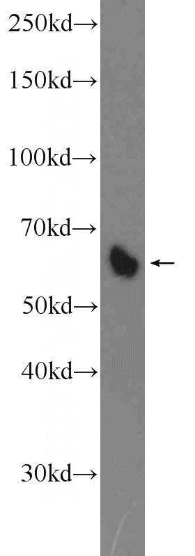 mouse liver tissue were subjected to SDS PAGE followed by western blot with Catalog No:116806(VTCN1 Antibody) at dilution of 1:600
