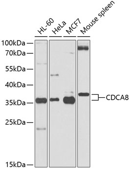Western blot - CDCA8 Polyclonal Antibody 