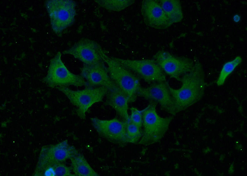 Immunofluorescent analysis of SH-SY5Y cells using Catalog No:112049(KIF5C Antibody) at dilution of 1:25 and Alexa Fluor 488-congugated AffiniPure Goat Anti-Rabbit IgG(H+L)