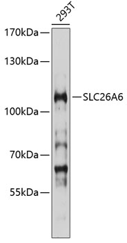 Western blot - SLC26A6 Polyclonal Antibody 