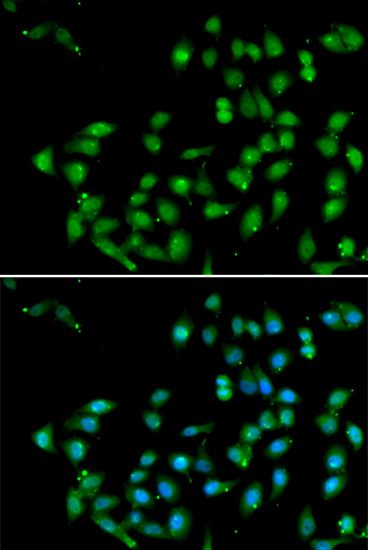 Immunofluorescence - CTNNBL1 Polyclonal Antibody 