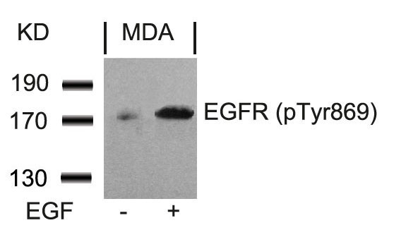 Western blot analysis of extracts from MDA cells untreated or treated with EGF using EGFR (Phospho-Tyr869) Antibody .