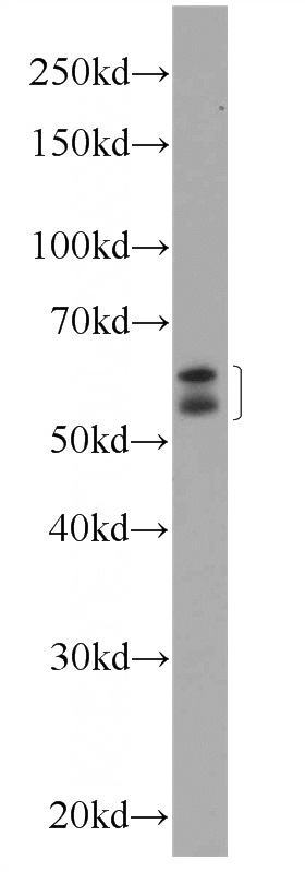 HeLa cells were subjected to SDS PAGE followed by western blot with Catalog No:113108(NELF Antibody) at dilution of 1:1000