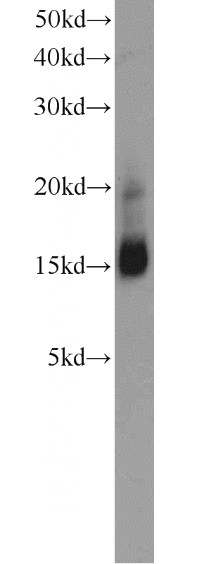 mouse brain tissue were subjected to SDS PAGE followed by western blot with Catalog No:109359(CNRIP1 antibody) at dilution of 1:1000