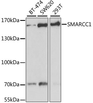 Western blot - SMARCC1 Polyclonal Antibody 
