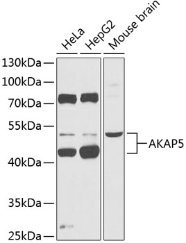 Western blot - AKAP5 Polyclonal Antibody 