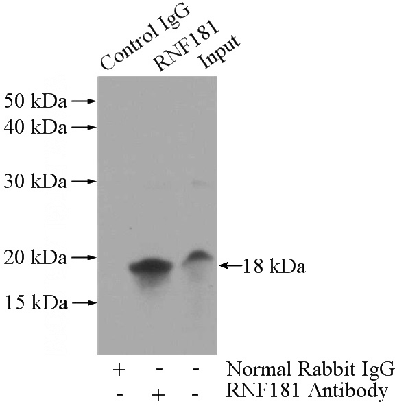 IP Result of anti-RNF181 (IP:Catalog No:114749, 3ug; Detection:Catalog No:114749 1:500) with Jurkat cells lysate 1200ug.
