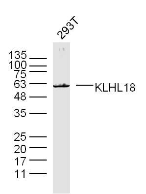 Fig3: Sample: 293T (human)cell Lysate at 40 ug; Primary: Anti-KLHL18 at 1/300 dilution; Secondary: IRDye800CW Goat Anti-Rabbit IgG at 1/20000 dilution; Predicted band size: 64 kD; Observed band size: 63 kD