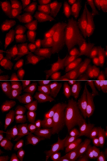 Immunofluorescence - PPP2R2A Polyclonal Antibody 