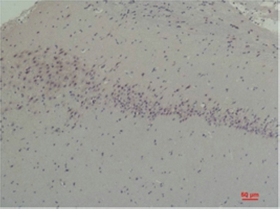 Fig2:; Immunohistochemical analysis of paraffin-embedded Rat Brain Tissue using CABP2 Rabbit pAb diluted at 1:200.