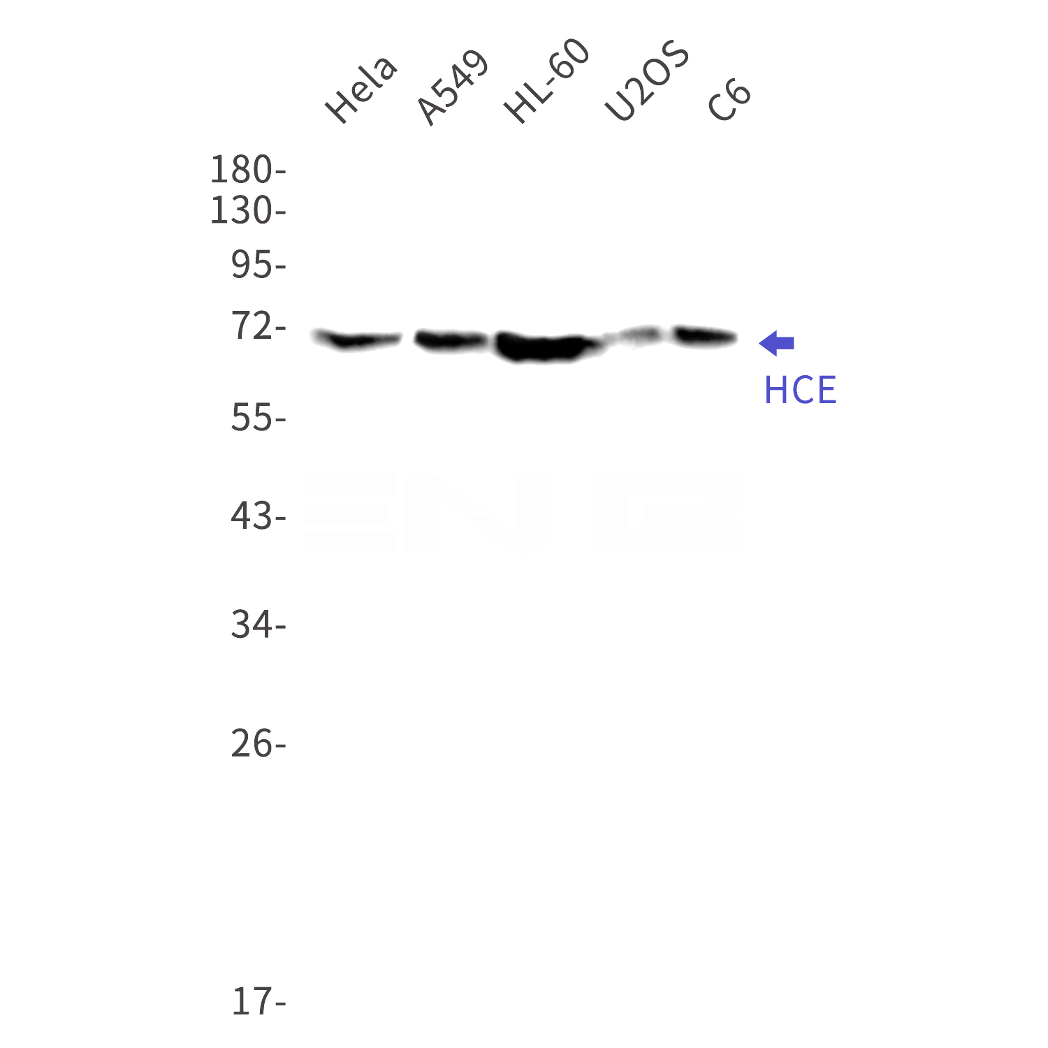 Western blot detection of HCE in Hela,A549,HL-60,U2OS,C6 cell lysates using HCE Rabbit mAb(1:1000 diluted).Predicted band size:69kDa.Observed band size:69kDa.