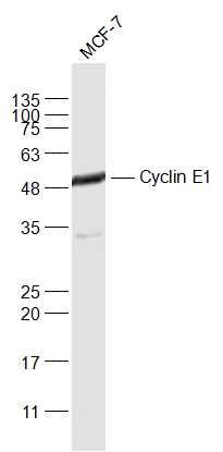 Fig7: Sample:; MCF-7(Human) Cell Lysate at 30 ug; Primary: Anti-Cyclin E1 at 1/1000 dilution; Secondary: IRDye800CW Goat Anti-Rabbit IgG at 1/20000 dilution; Predicted band size: 45 kD; Observed band size: 48 kD