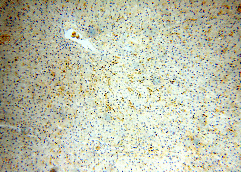 Immunohistochemical of paraffin-embedded human liver using Catalog No:111267(HBD antibody) at dilution of 1:100 (under 10x lens)