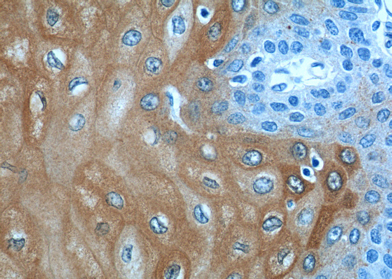 Immunohistochemistry of paraffin-embedded human oesophagus tissue slide using Catalog No:111772(IL1RN Antibody) at dilution of 1:50 (under 40x lens)