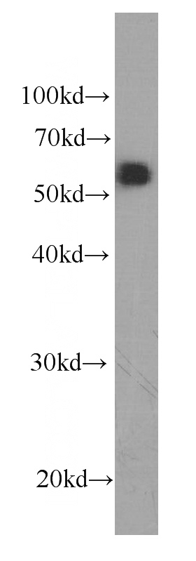 L02 cells were subjected to SDS PAGE followed by western blot with Catalog No:107060(SERPINC1 Antibody) at dilution of 1:1000