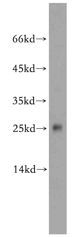 HeLa cells were subjected to SDS PAGE followed by western blot with Catalog No:114147(PPP1R11-Specific antibody) at dilution of 1:100