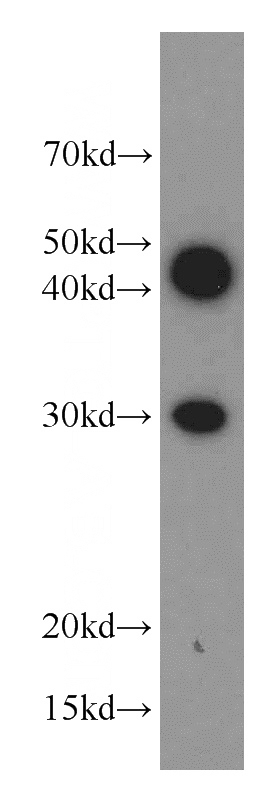 SW 1990 cells were subjected to SDS PAGE followed by western blot with Catalog No:114419(RAB20 antibody) at dilution of 1:1000