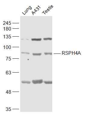 Fig1: Sample:; Lung (Mouse) Lysate at 40 ug; A431(Human) Cell Lysate at 30 ug; Testis (Mouse) Lysate at 40 ug; Primary: Anti-RSPH4A at 1/1000 dilution; Secondary: IRDye800CW Goat Anti-Rabbit IgG at 1/20000 dilution; Predicted band size: 81 kD; Observed band size: 81 kD