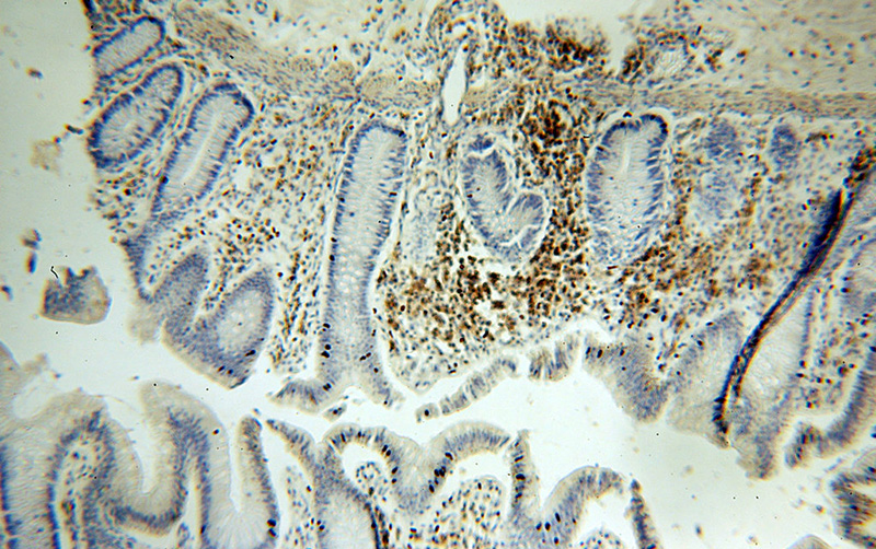 Immunohistochemical of paraffin-embedded human colon using Catalog No:111591(ICAM3 antibody) at dilution of 1:100 (under 10x lens)