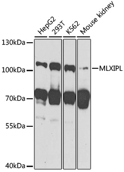 Western blot - MLXIPL Polyclonal Antibody 